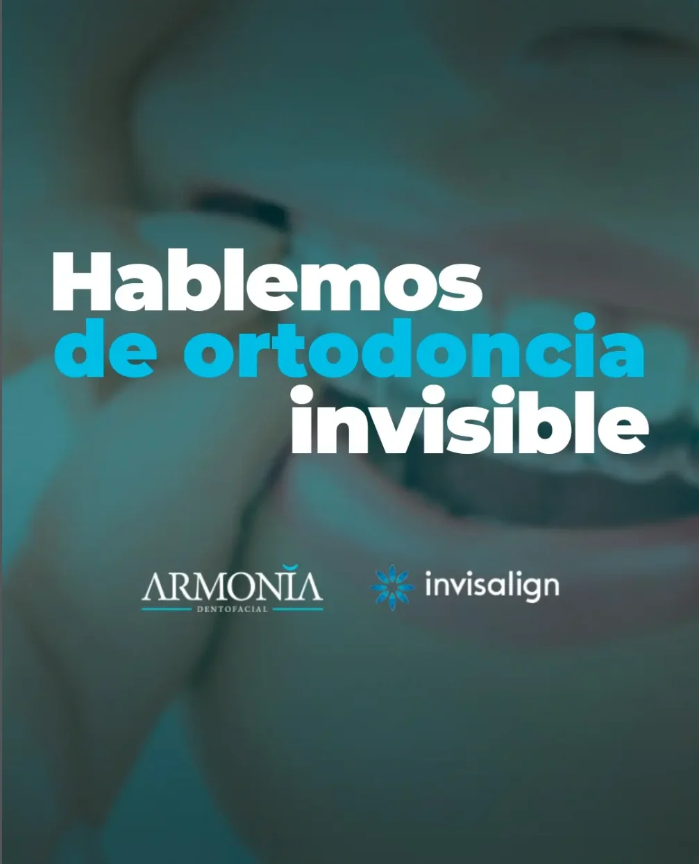 Ortodoncia invisible