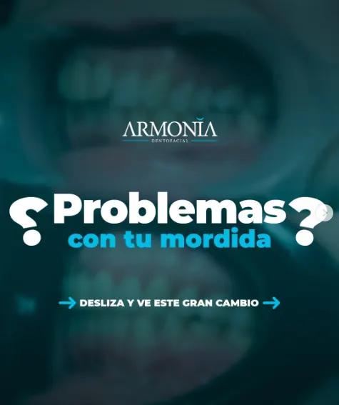 Problemas con la mordida