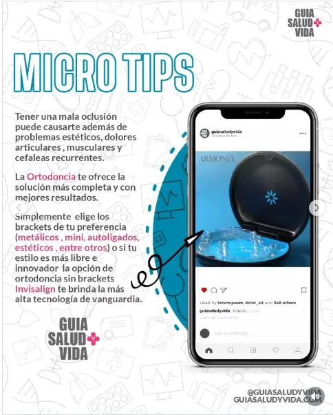 Microtips ortodoncia